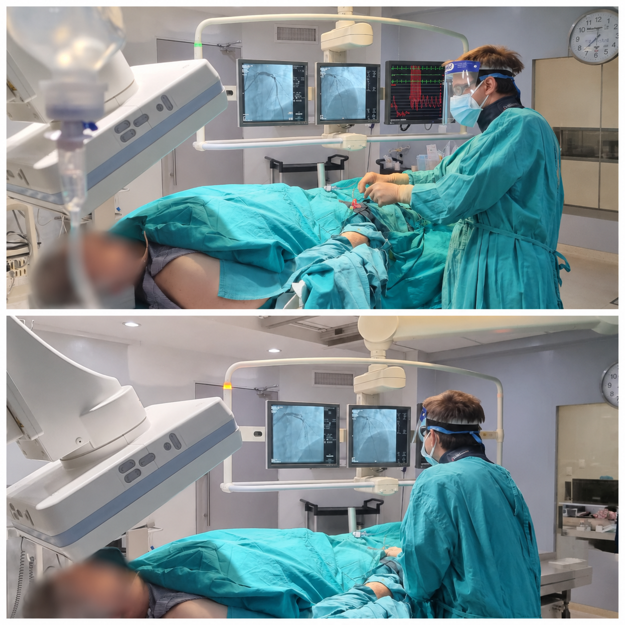 Angioplastía coronaria con stent - Dr. Walter Herrera, clínica cardiológica en San Salvador Angioplastía coronaria con stent - Procedimiento de cardiología intervencionista por el Dr. Walter John Herrera Rucaj